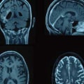 Understanding Nuclear Medicine Imaging and Its Safety Implications
