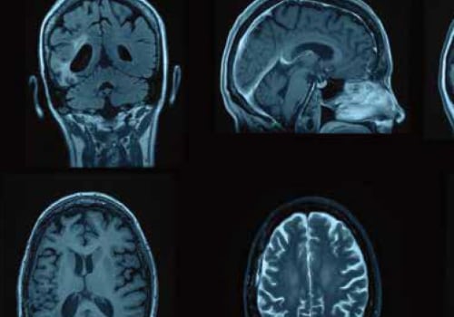 Understanding Nuclear Medicine Imaging and Its Safety Implications